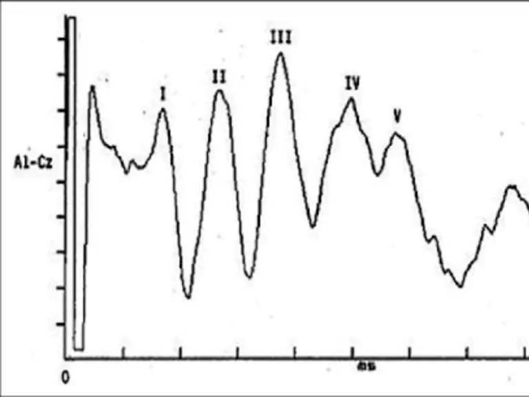 BERA-Test-Normal-Range